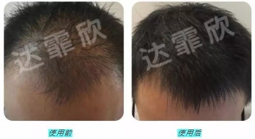 ֹ������ ��������Tony��ʦ������