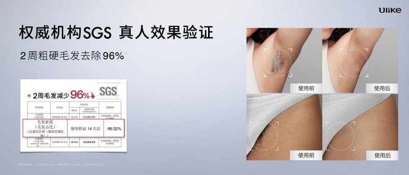 全球销量第一的脱毛仪品牌Ulike发布超级脱毛技术或将实现永久脱毛